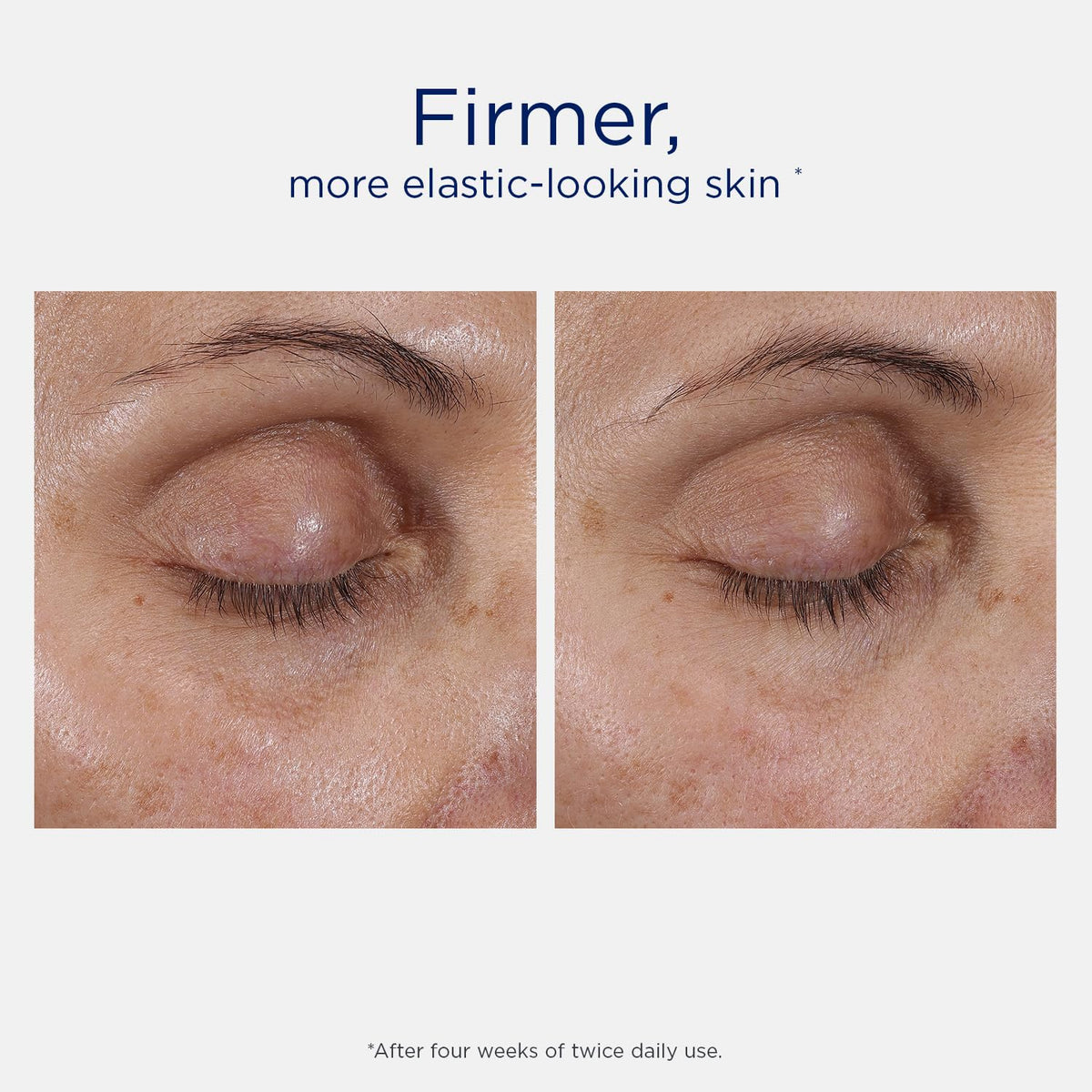 Close-up of NEOSTRATA Skin Active Intensive Eye Therapy cream texture