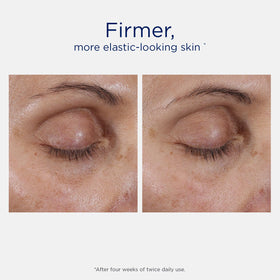 Close-up of NEOSTRATA Skin Active Intensive Eye Therapy cream texture