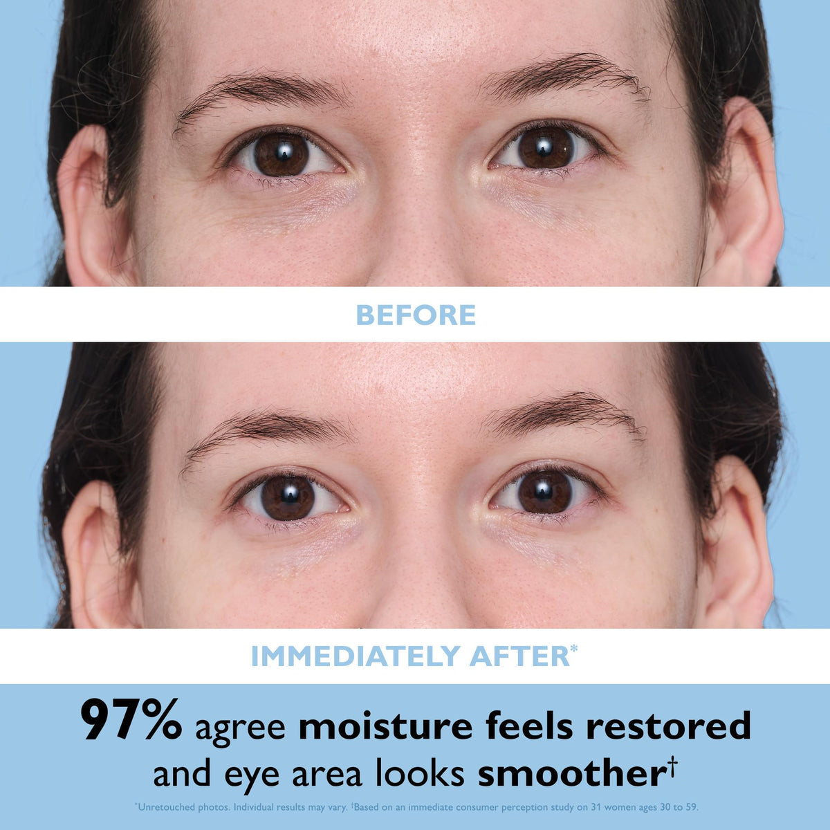 Close-up of Peter Thomas Roth Hyaluronic Cloud Eye Patches