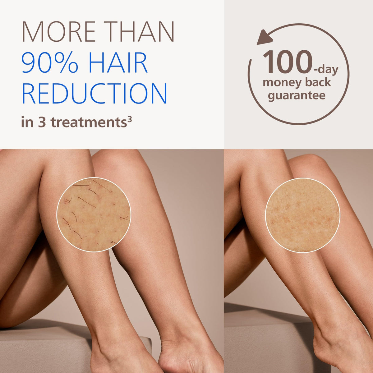 Close-up of PHILIPS Lumea IPL device showing SenseIQ technology