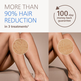 Close-up of PHILIPS Lumea IPL device showing SenseIQ technology
