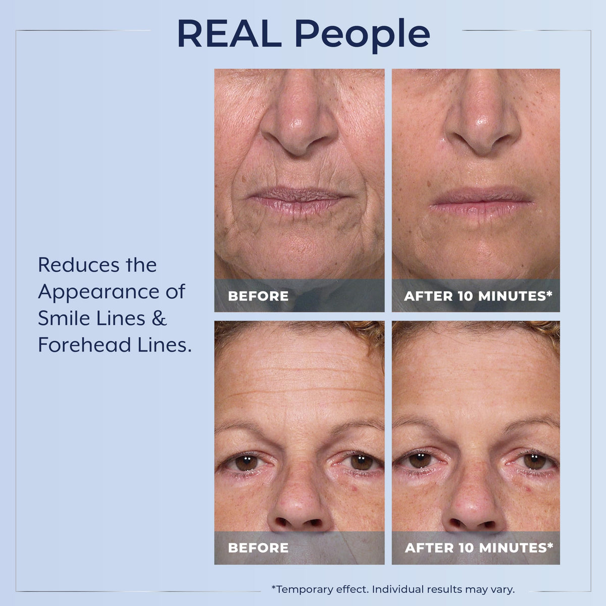 Close-up of Plexaderm serum texture