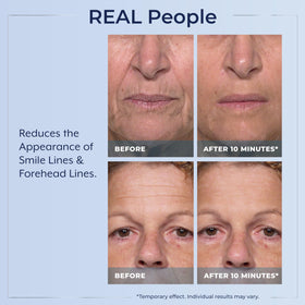 Close-up of Plexaderm serum texture