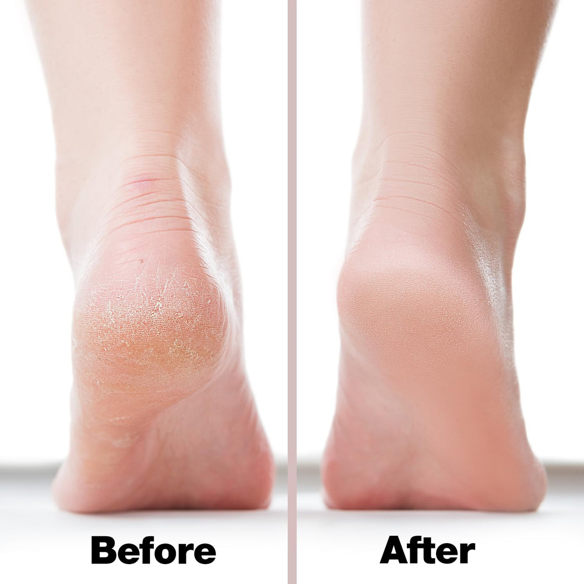 Close-up of Probelle foot file handle for easy grip