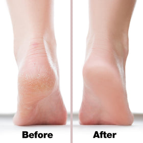 Close-up of Probelle foot file handle for easy grip