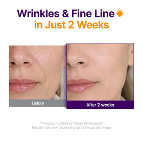 Close-up of PURITO Retinol + Retinal Serum dropper