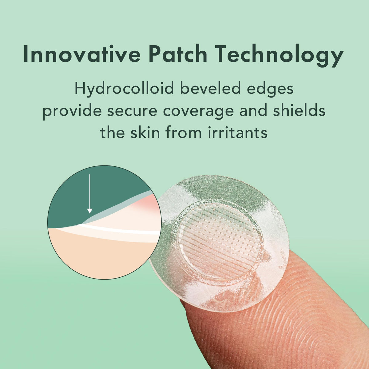 Close-up of Rael Hydrocolloid Pimple Patch on skin