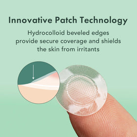 Close-up of Rael Hydrocolloid Pimple Patch on skin