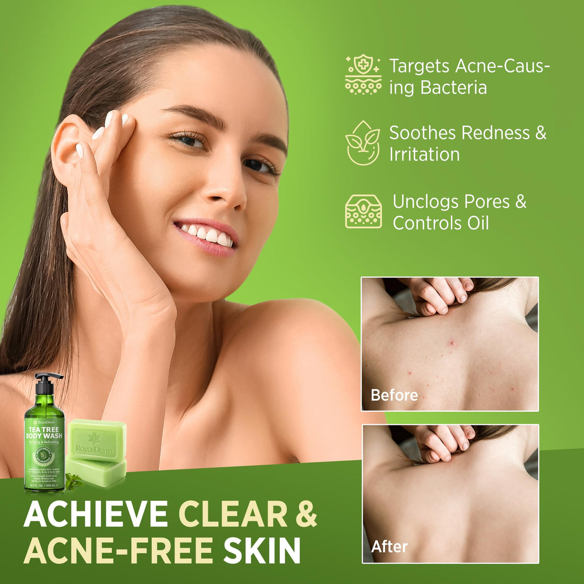 Close-up of Roycederm Tea Tree Body Wash bottle