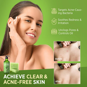 Close-up of Roycederm Tea Tree Body Wash bottle