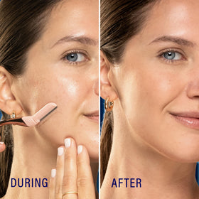 Close-up of Schick Hydro Silk Dermaplaning Wand blades