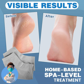 Close-up of TEAWOO toeless socks showing moisturizing gel