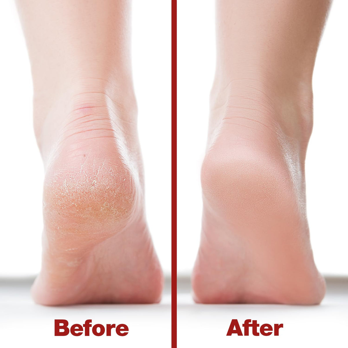 Close-up of the coarse side of Probelle Foot File