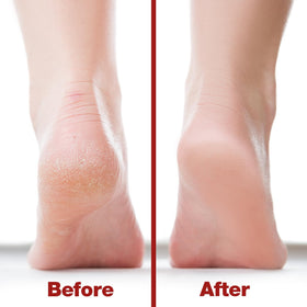 Close-up of the coarse side of Probelle Foot File