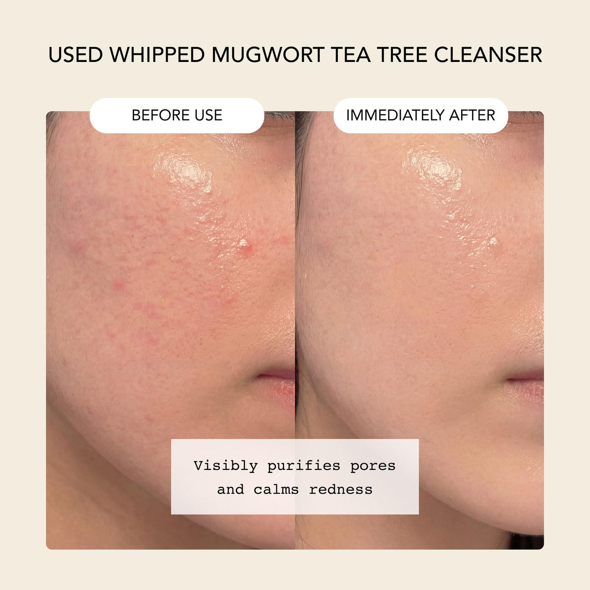 Close-up of Whipped Korean Face Wash texture