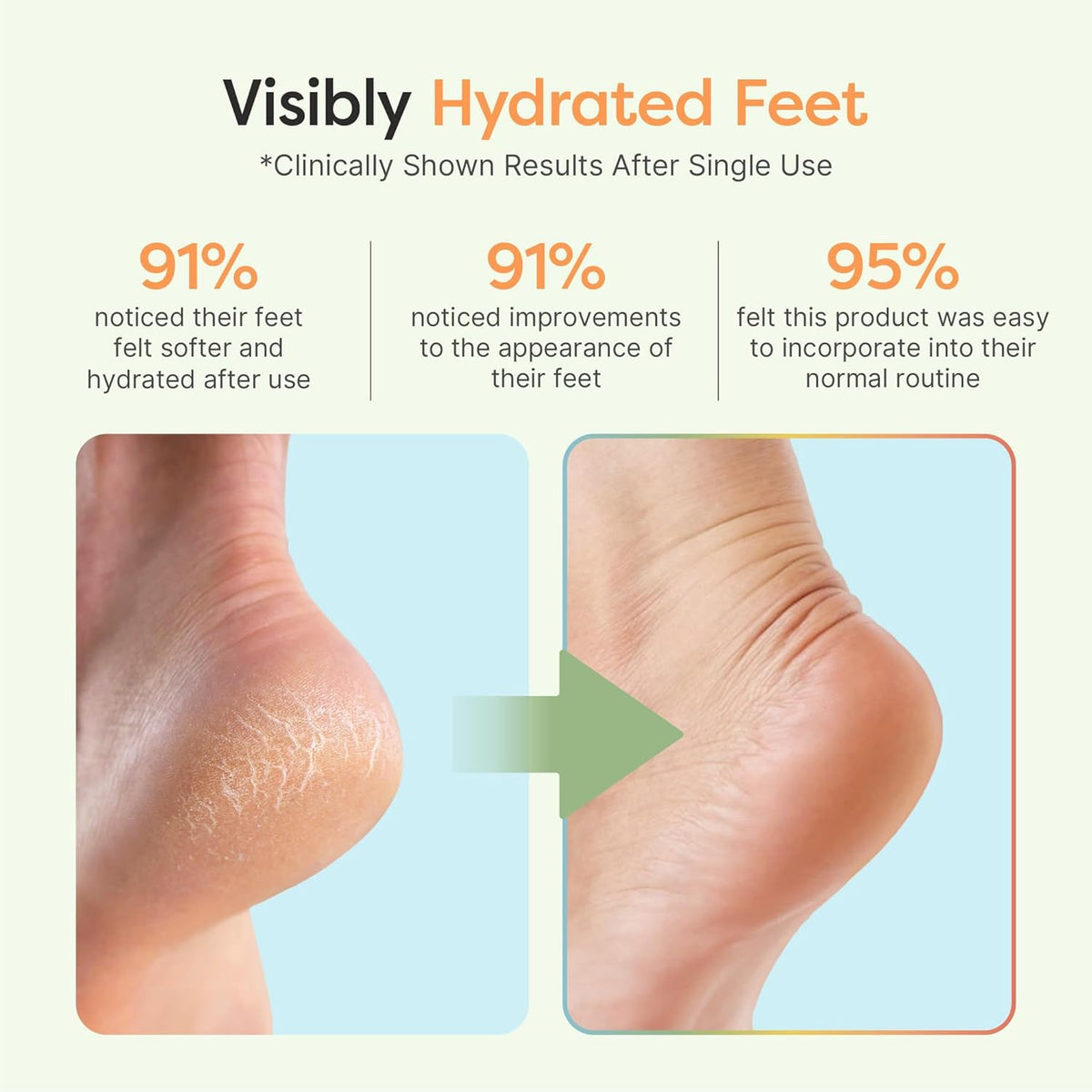 Close-up of ZenToes Moisturizing Heel Socks showing gel lining