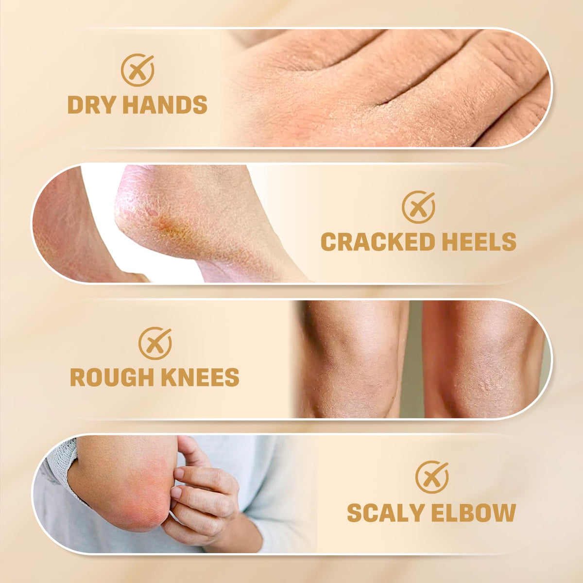 Clyecfra 60% Urea Cream in a lifestyle setting