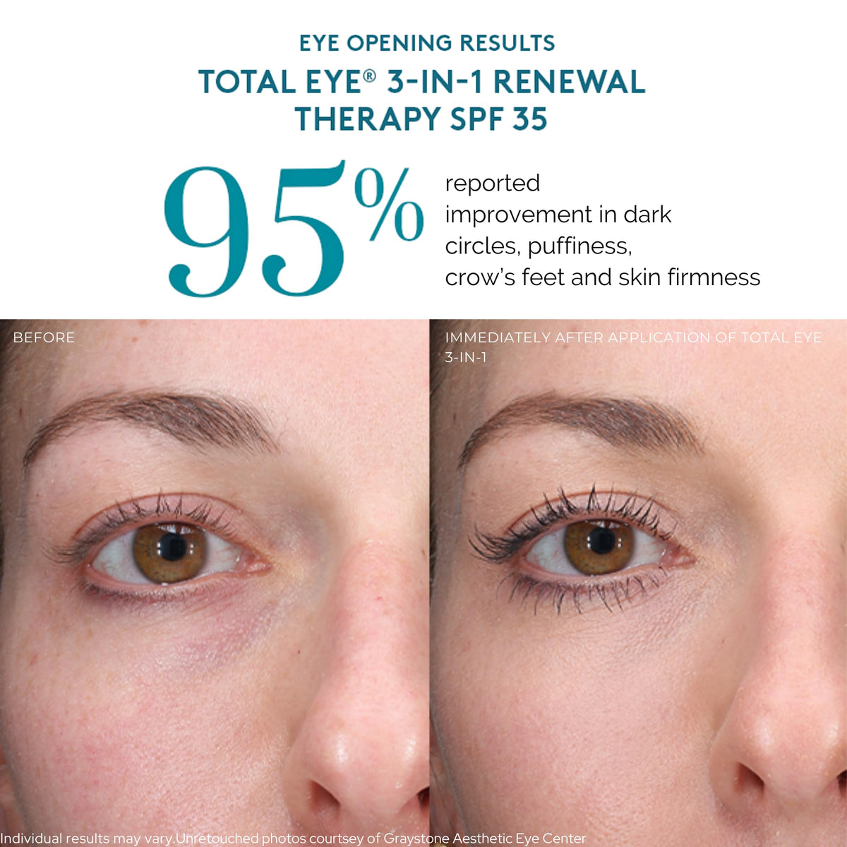 Colorescience Total Eye 3-in-1 Renewal Therapy SPF 35, Deep lifestyle shot