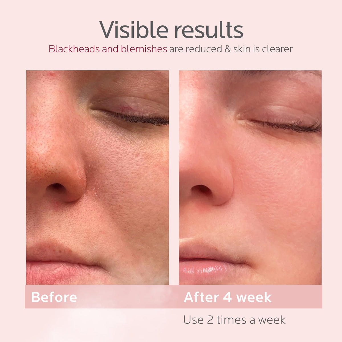 colorfarm facial steamer kit packaging in rose gold
