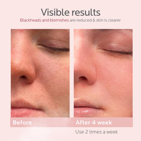 colorfarm facial steamer kit packaging in rose gold