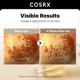 COSRX 2% Alpha Arbutin Serum with ingredients displayed