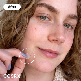 COSRX Acne Pimple Patches packaging with size details