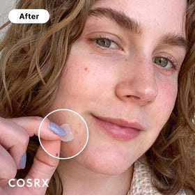 COSRX Acne Pimple Patches showing different sizes
