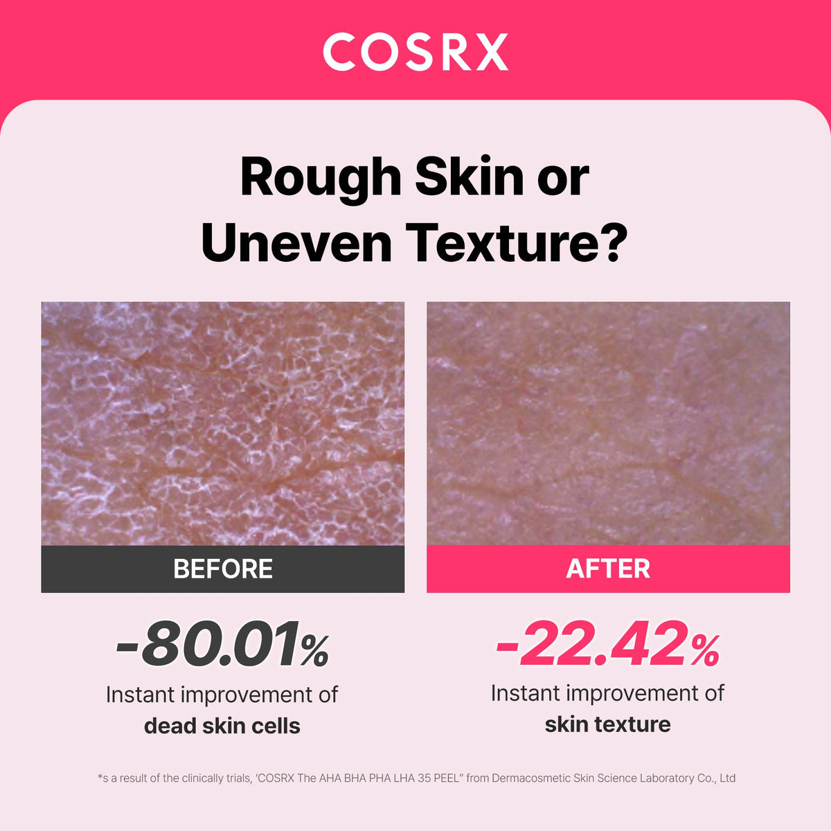 COSRX AHA BHA PHA LHA 35% Peel Exfoliating Gel application on skin