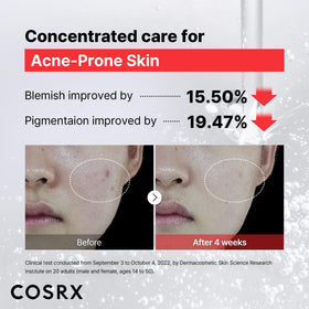 COSRX Niacinamide Face Serum 15% with dropper