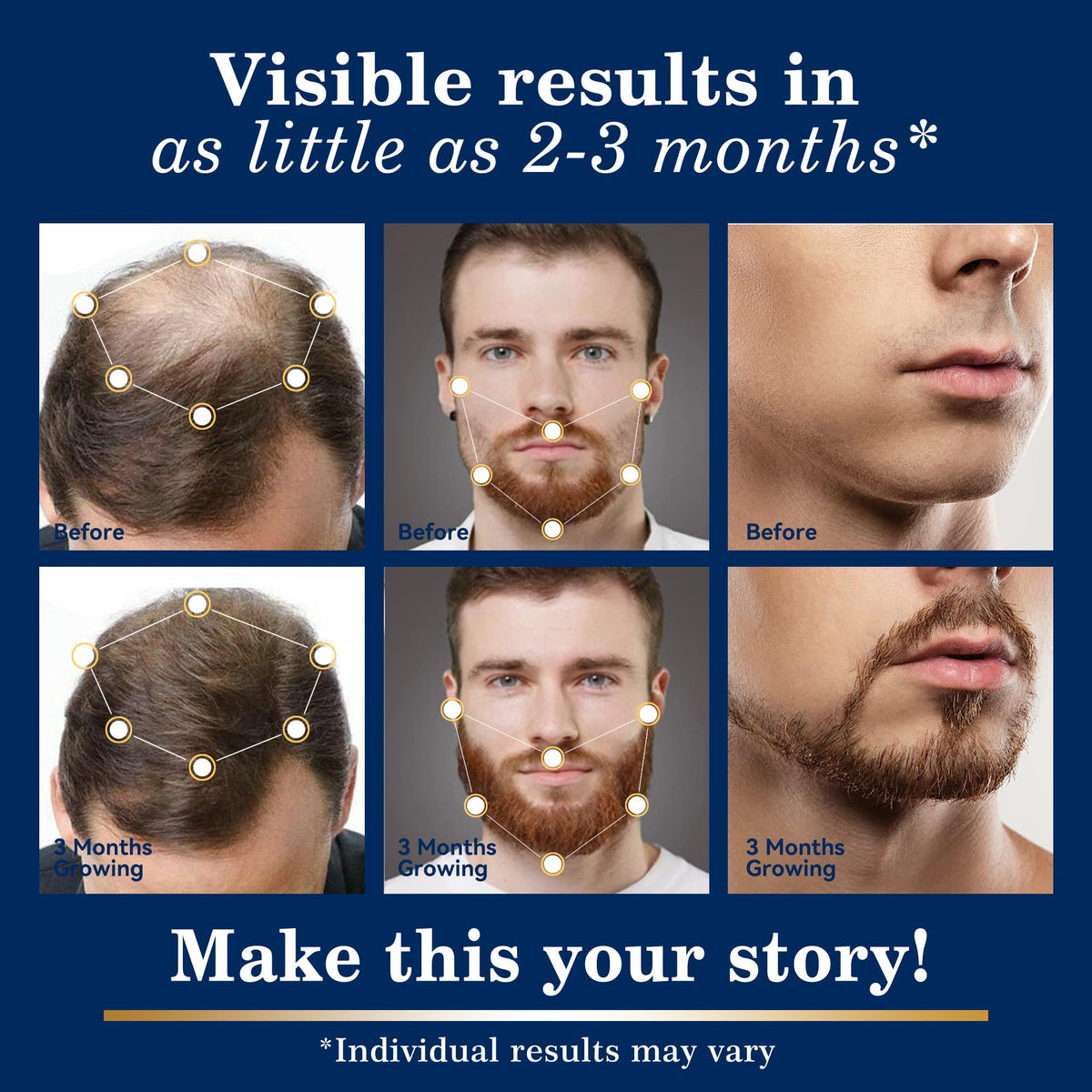 DAAZZS 5% Minoxidil spray nozzle close-up