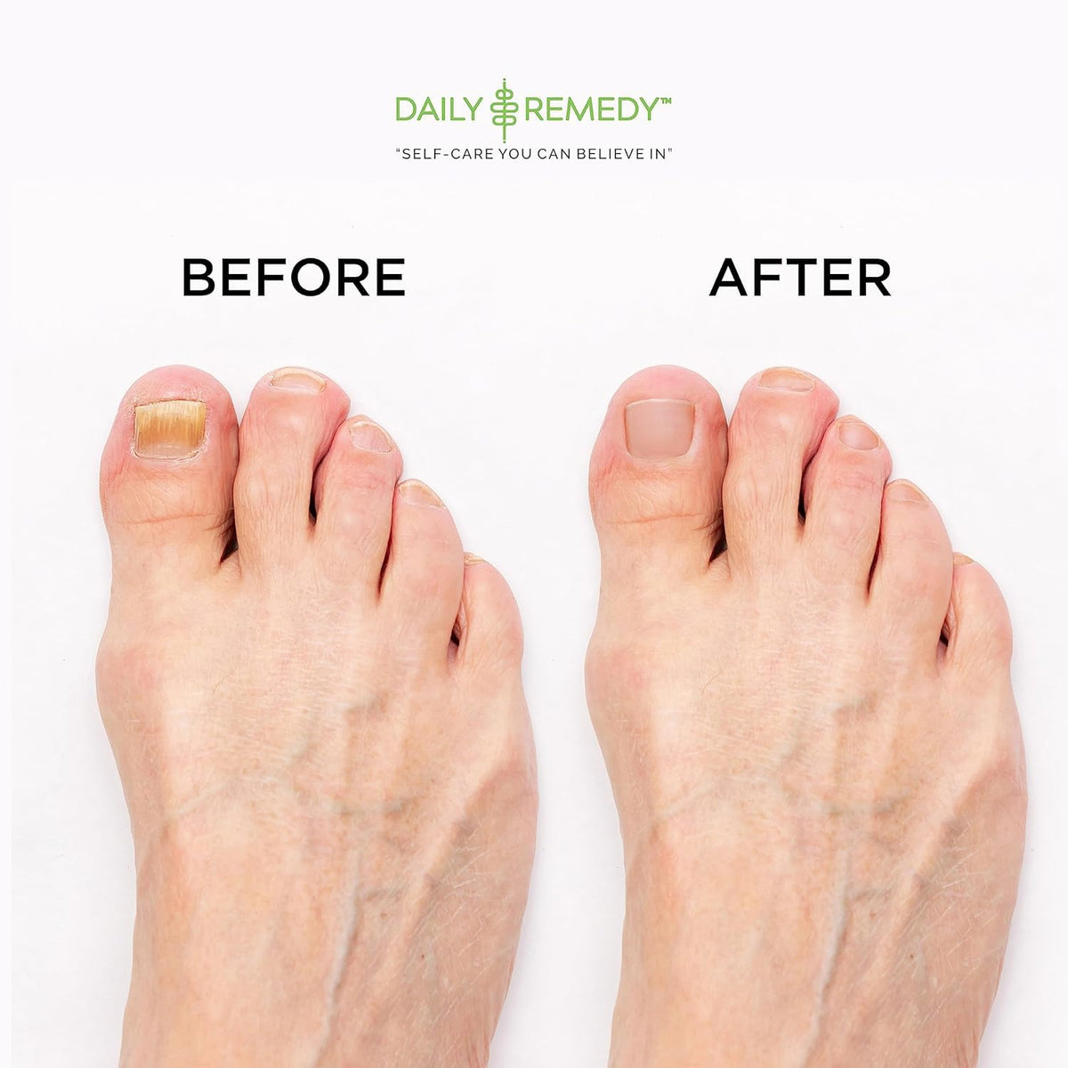 DAILY REMEDY foot soak with Epsom salt and essential oils