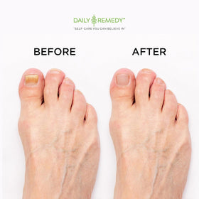 DAILY REMEDY foot soak with Epsom salt and essential oils