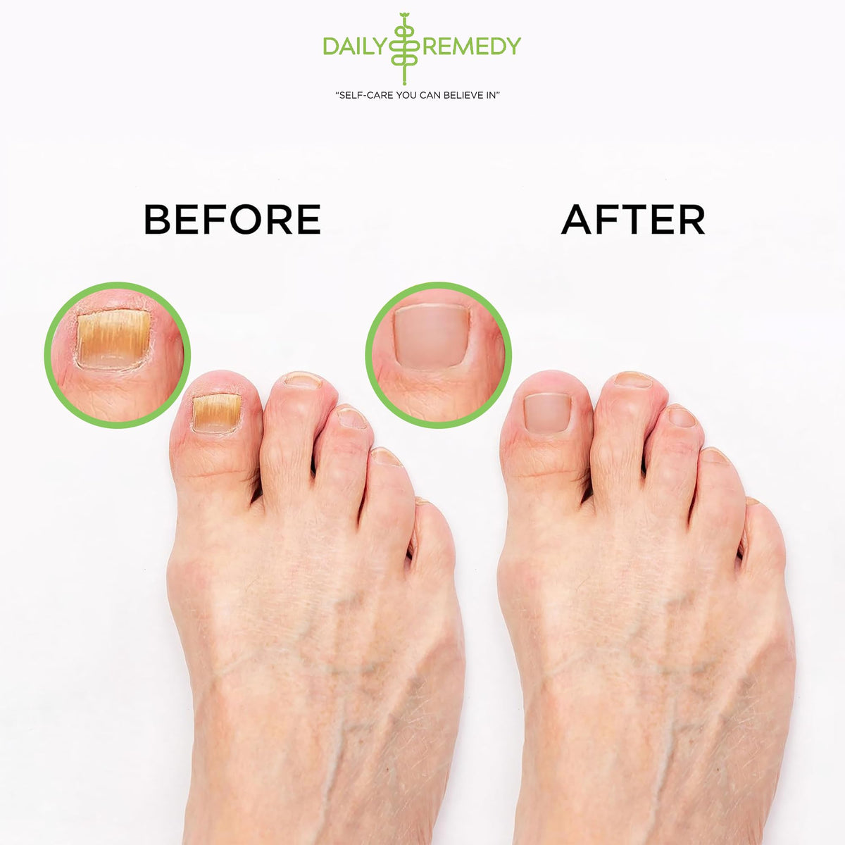 DAILY REMEDY Tea Tree Oil Foot Soak being poured into a bowl