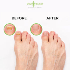 DAILY REMEDY Tea Tree Oil Foot Soak being poured into a bowl