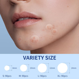 Daolyo Pimple Patch applied on skin for blemish coverage
