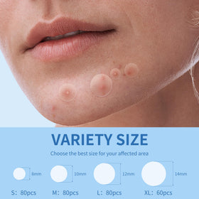 Daolyo Pimple Patches applied on skin