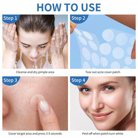 Daolyo Pimple Patches displayed on a clean surface