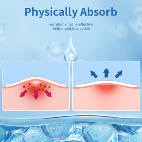 Daolyo Pimple Patches in use during nighttime