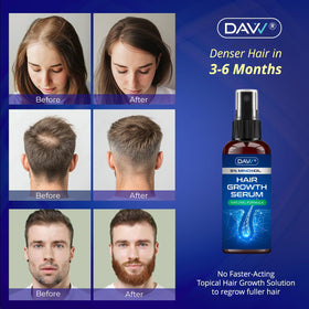 DAVV 5% Minoxidil Spray back view
