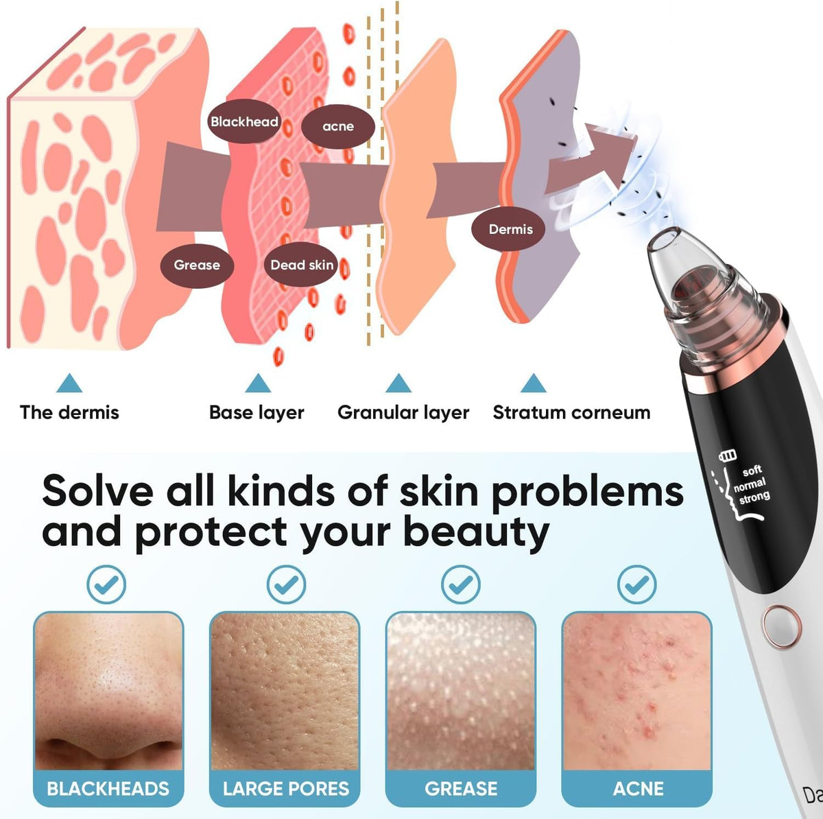 Daweir Blackhead Remover Pore Vacuum in use on facial skin