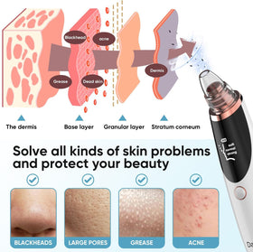 Daweir Blackhead Remover Pore Vacuum in use on facial skin