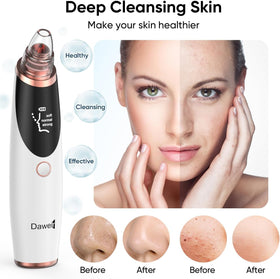 Daweir Blackhead Remover Pore Vacuum showing 5 replaceable tips