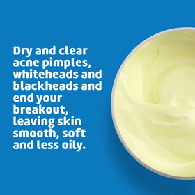 De La Cruz Sulfur Ointment application on skin