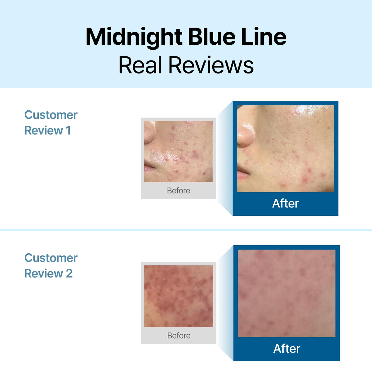DearKlairs Blue Calming Cream side view