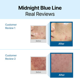 DearKlairs Midnight Blue Calming Cream texture close-up