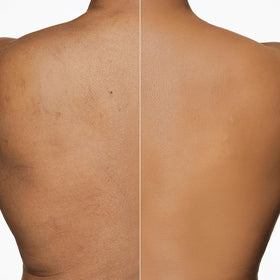 Dermablend Leg & Body Makeup Foundation SPF 25 packaging
