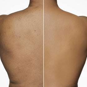 Dermablend Leg & Body Makeup Foundation SPF 25 with setting powder