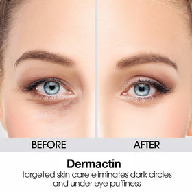 Dermactin Anti-Aging Fine Lines Wrinkle Cream 1 oz. side view