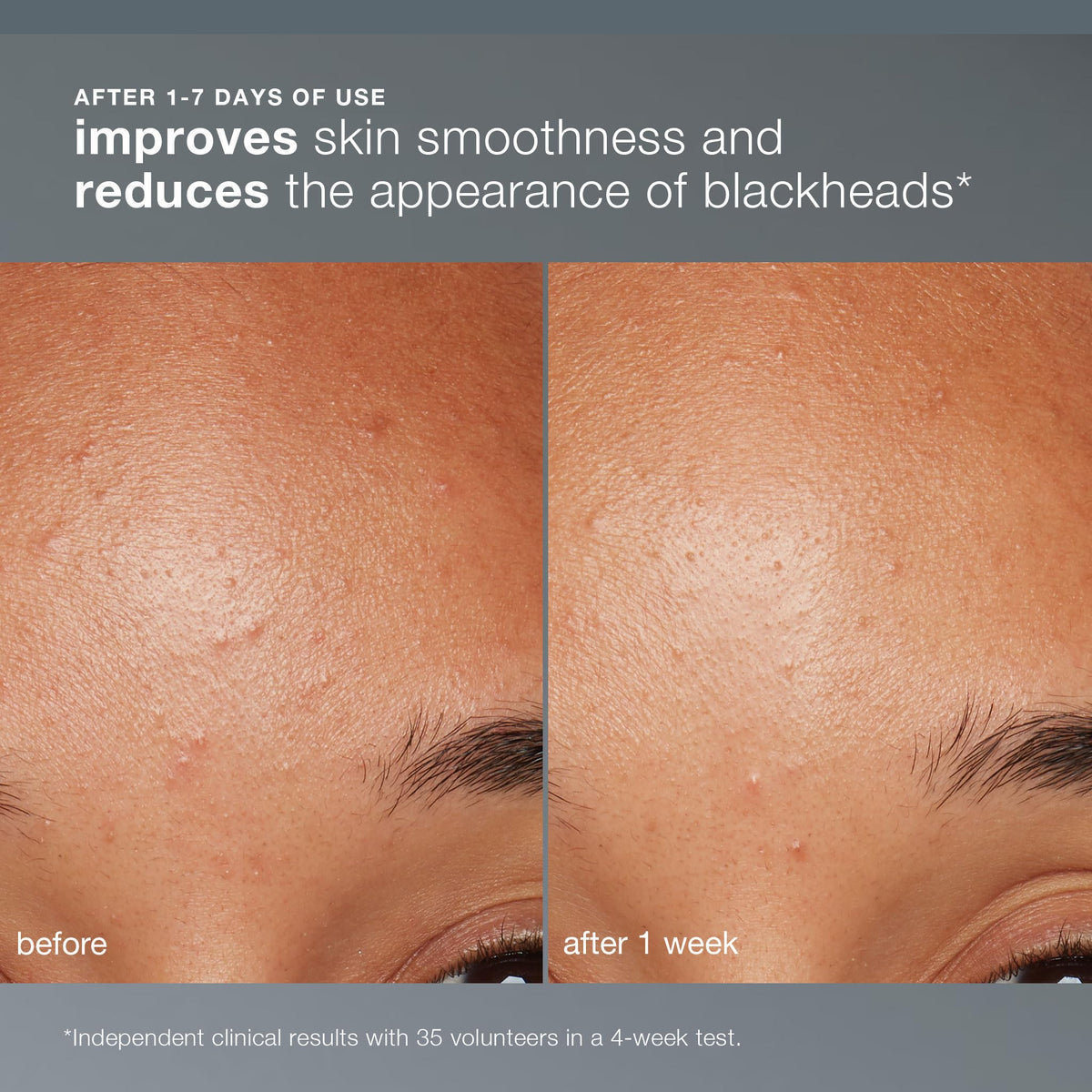 Dermalogica Daily Microfoliant Exfoliating Powder texture close-up