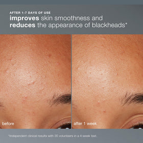 Dermalogica Daily Microfoliant Exfoliating Powder texture close-up